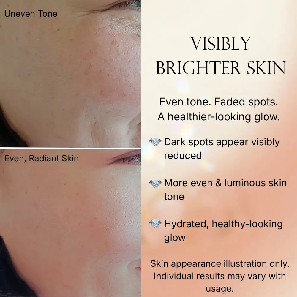 Caramela Beauty Even Tone Serum – Brightening Serum for Dark Spots & Hyperpigmentation with Kojic Acid, Hyaluronic Acid & Centella Asiatica – Radiant Healthy Glow – 1 Fl Oz / 30Ml